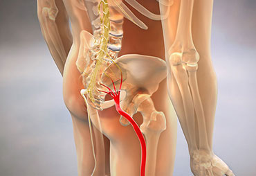 Sciatica nerve diagram