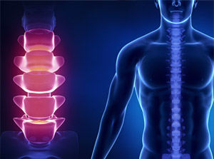 Education about lower back pain following an auto accident